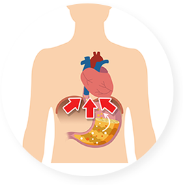 담적 2단계 — 위장의 가스가 위로 심장을 압박하는 모습 일러스트